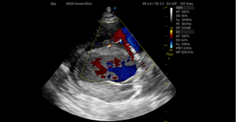 TVI (Tissue Velocity Imaging)_CF